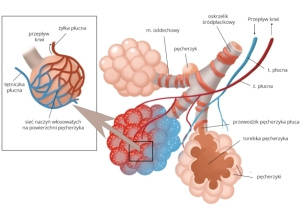 choroba popcornowych płuc, Diacetyl AP zagrożenie, zapalenie oskrzelików zarostowe grafika - Zarostowe zapalenie oskrzelików | Pulmonologia - mp.pl