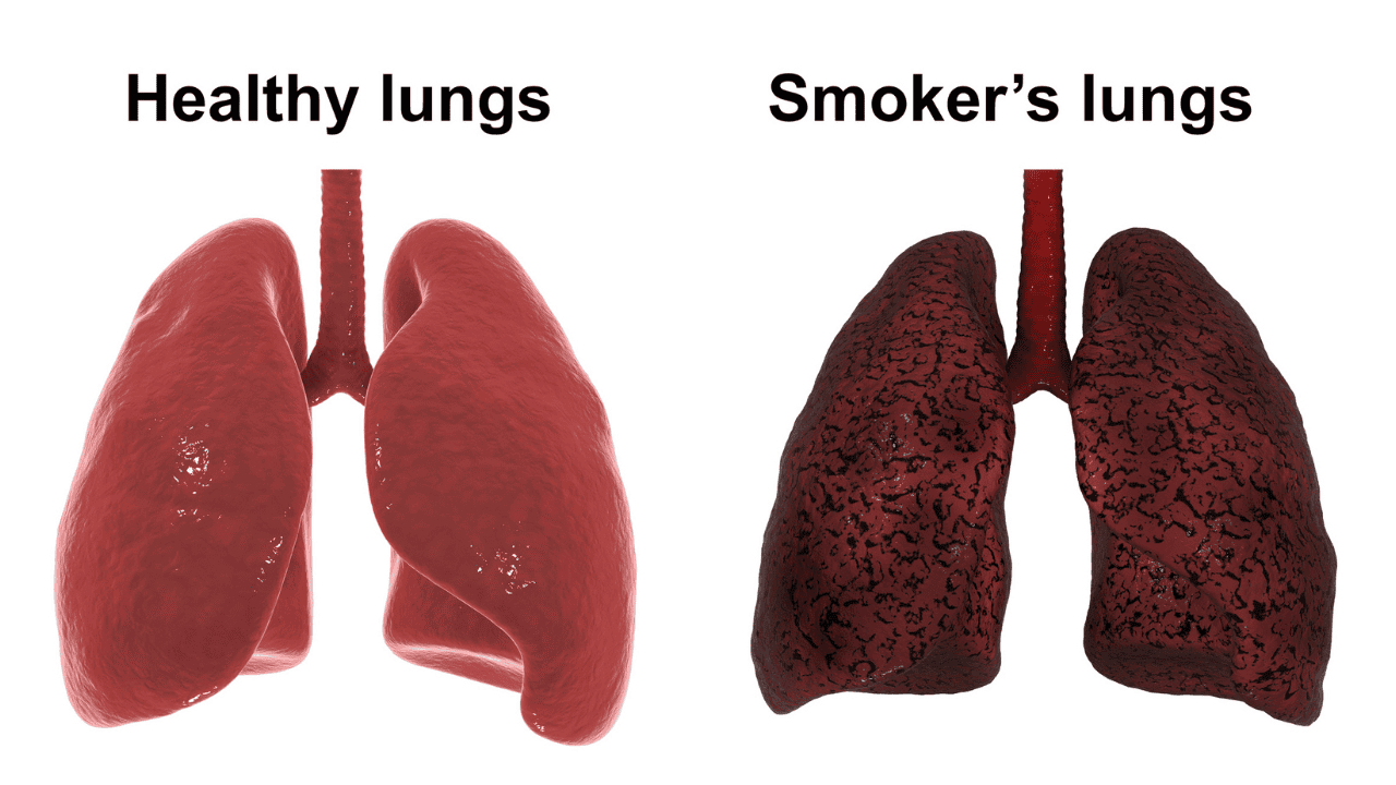 Obraz przedstawiający czyste, zdrowe płuca w kontraście do płuc uszkodzonych przez substancje smoliste z papierosów, podkreślający brak smoły w jednorazówkach